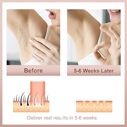 FDA Cleared Hair Removal for Women and Men, At Home High Energy IPL Hair Remo...