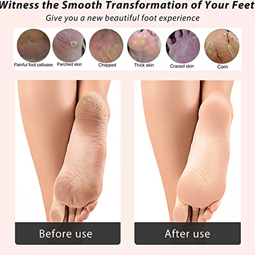 ICANdOIT Natural Bamboo Foot File Callus Remover-Multi Purpose 4 in 1 Feet Pe...