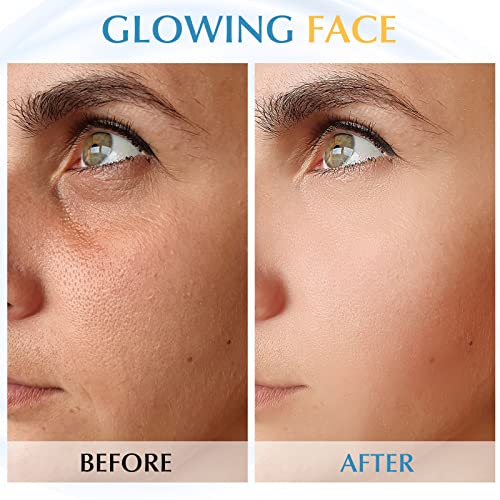 Derma Roller Microneedle Micro Dermaroller: Needle Facial Microneedling Needl...