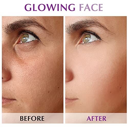 Derma Roller Skin Dermaroller Microneedle: Skin Rollers Micro Needle Kit 0.25...