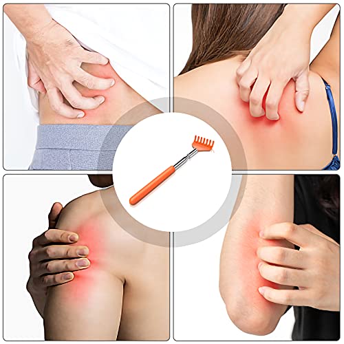 Back Scratchers - iGreely 5-Pack Handy Extendable Portable Telescopic Stainle...