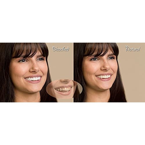 Imako Cosmetic Upper Teeth 1 Pack (Small, Natural)