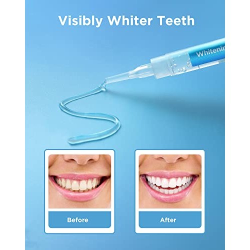Teeth Whitening Gel Syringes, 8 Packs, 35% Carbamide Peroxide Whitening Gel R...