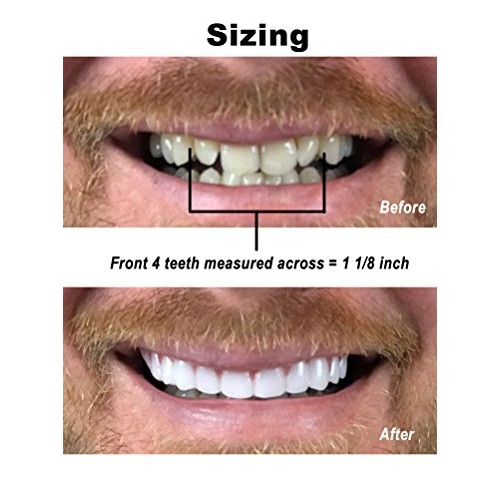 Instant Smile Comfort Fit Flex - Bright White Shade - Cosmetic Teeth, Comfort...