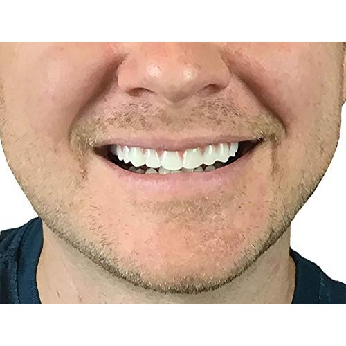 Instant Smile Comfort Fit Flex - Natural Shade - Upper Veneer Cosmetic Teeth