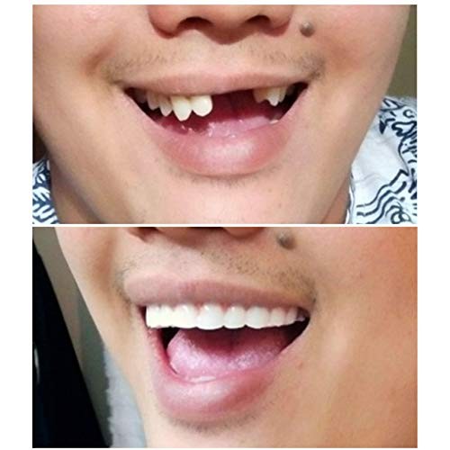 Instant Smile Comfort Fit Flex - Natural Shade - Upper Veneer Cosmetic Teeth