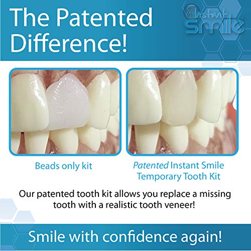 Instant Smile Complete Your Smile Temporary Tooth Replacement Kit - Replace a...