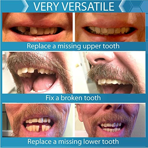 Instant Smile Complete Your Smile Temporary Tooth Replacement Kit - Replace a...