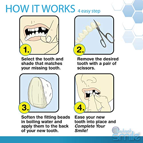 Instant Smile Complete Your Smile Temporary Tooth Replacement Kit - Replace a...