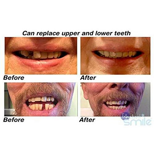 Instant Smile Multi-Shade Patented Temporary Tooth Repair Kit.