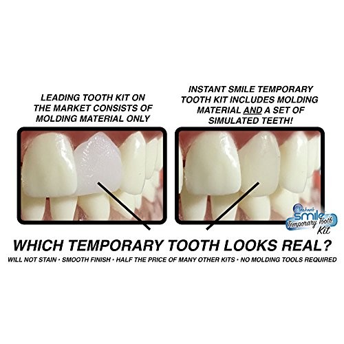 Instant Smile MULTISHADE Patented Temporary Tooth Repair Kit. A Realistic Loo...