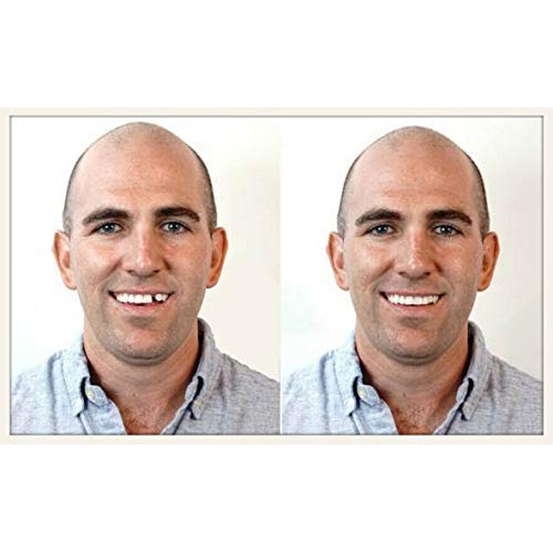 Instant Smile Select A Tooth Temporary Tooth Replacement Kit - 3 Pack Combo -...