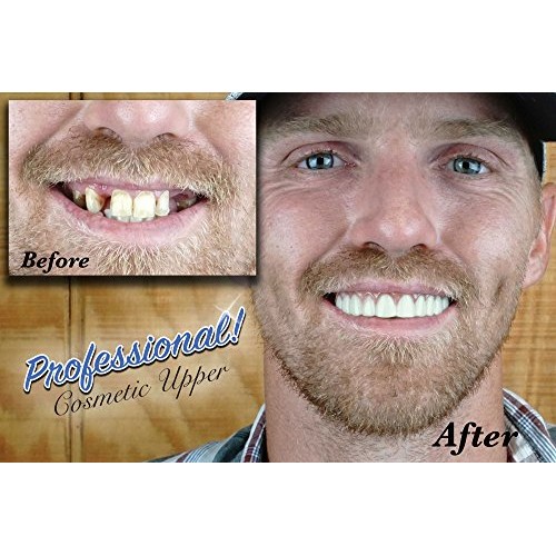 Professional Cosmetic Upper - New from Instant Smile! Hand crafted detail, cu...