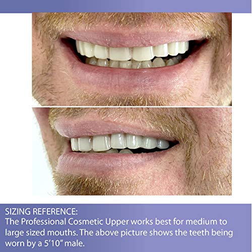 Professional Cosmetic Upper - New from Instant Smile! Hand crafted detail, cu...