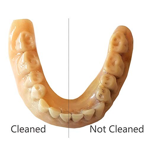 iSonic F3900 Ultrasonic Denture/Aligner/Retainer Cleaner for all dental and s...