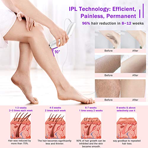 at-Home Hair Removal for Women & Men, Upgraded to 999,999 Flashes Laser Hair ...