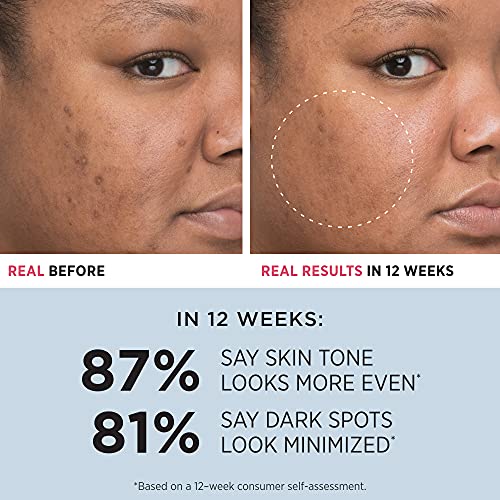 IT Cosmetics Bye Bye Dark Spots 4% Niacinamide Serum - Visibly Reduces Dark S...