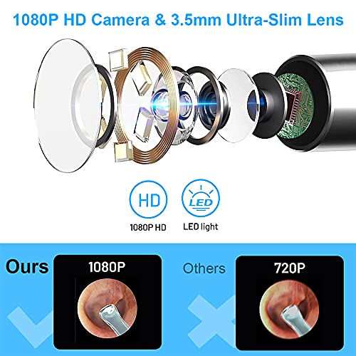 Ear Wax Removal, Earwax Remover Tool with 1080P HD, Waterproof, Easy Use, 3.5...