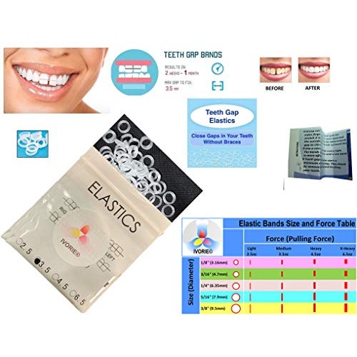 IVORIE Dental Cosmetic Ortho Elastic Rubber Bands Braces Teeth Gap Alignment ...