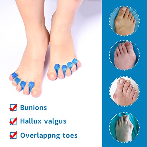 JADE KIT Toe Separator - 2 Packs - Silicone Bunion Pads for Overlapping Toes ...