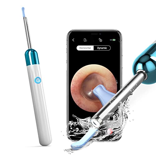 JAJALUYA Ear Wax Removal Endoscope,Earwax Remover Tool,Ear Wax Remover with C...