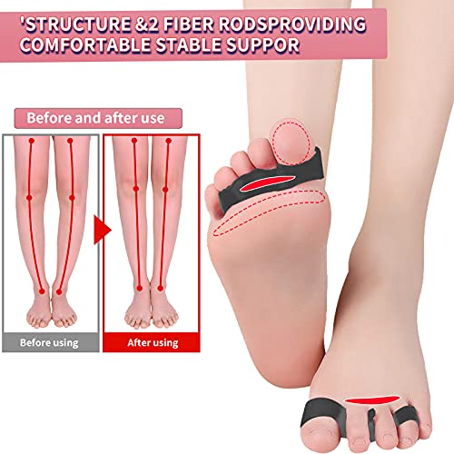 Toe Spacers,Toe Separators for Overlapping Toes,Correct Toes,Hammer Toe Corre...