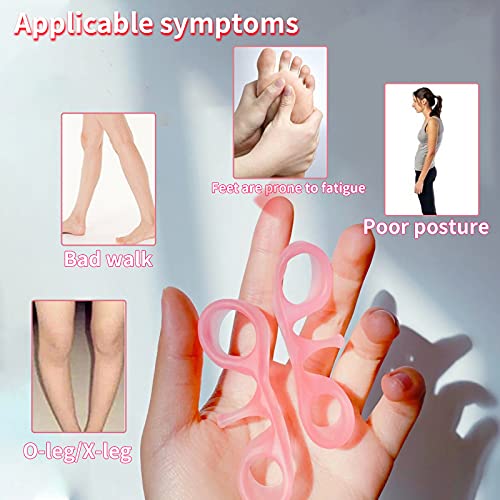 Toe Spacers,Toe Separators for Overlapping Toes,Correct Toes,Hammer Toe Corre...