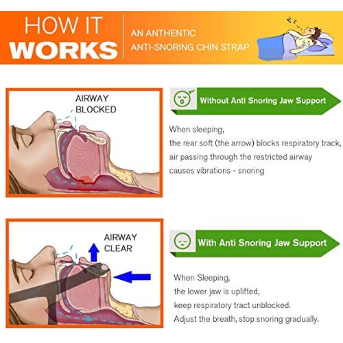 Anti Snoring Chin Strap(Blue) Snoring Solution Anti Snoring Devices Effective...