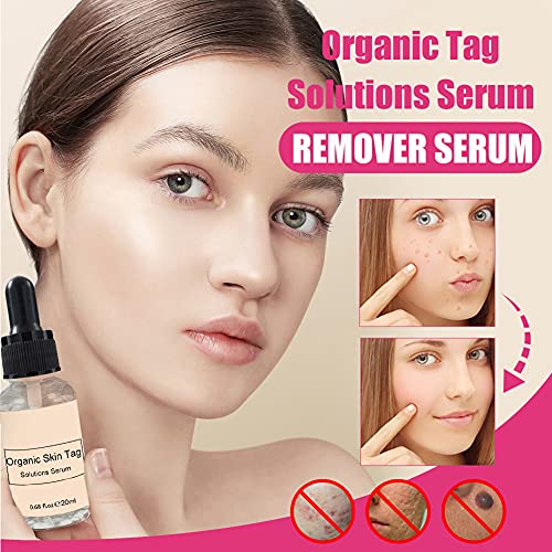 Jemets Skin Tag Remover Liquid Genital Wart Treatment Papillomas Removal Of W...