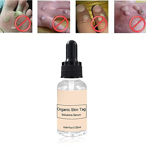 Jemets Skin Tag Remover Liquid Genital Wart Treatment Papillomas Removal Of W...