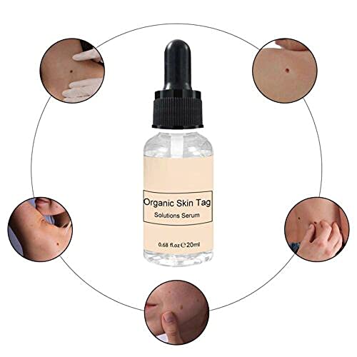 Jemets Skin Tag Remover Liquid Genital Wart Treatment Papillomas Removal Of W...