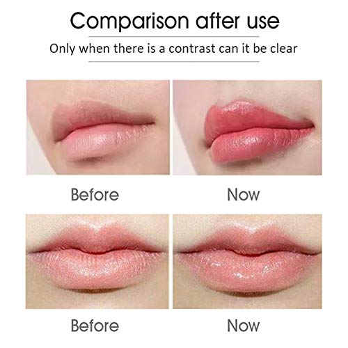 JINGBO 2 in 1 Hyaluron Pen, 0.3ML/0.5ML Hyaluronic Acid Syringe Pen Skin Care...