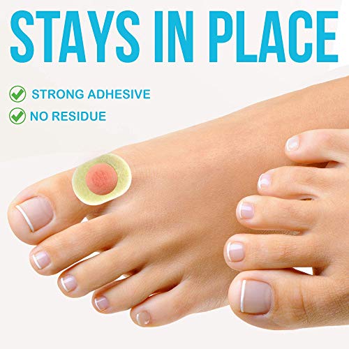 JJ CARE Corn Cushions [Box of 80] Corn Pads for Feet, Soft Felt Corn Pads for...