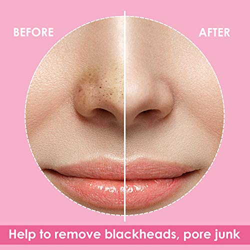 JOLVKA Blackhead Pore Strips ,30 strips, Blackhead Remover Deep Cleansing Por...