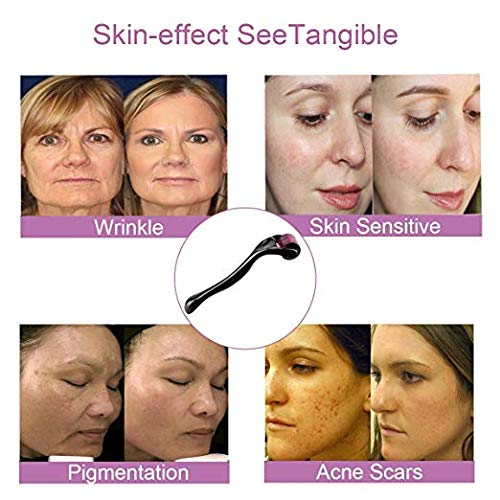 Derma Roller, Titanium Microneedle Roller for Face 540 Micro Needles New Cosm...