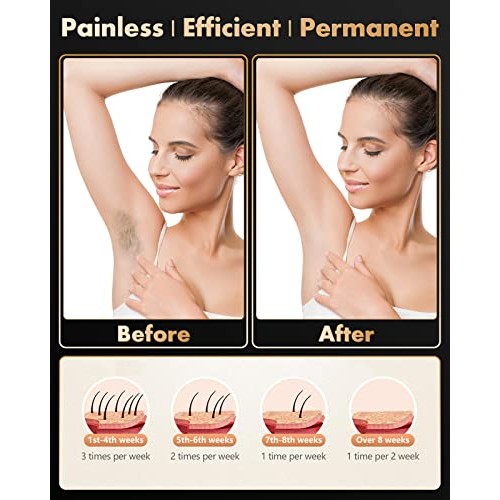 Laser Hair Removal for Women & Men, Permanent IPL Hair Removal Device for Fac...