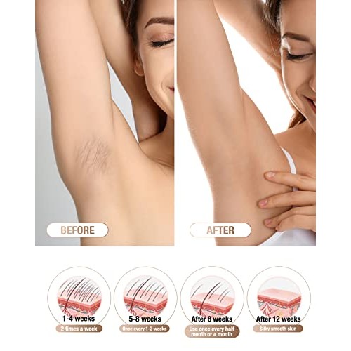 Laser Hair Removal for Women Permanent - IPL Hair Removal with 2 Intelligent ...