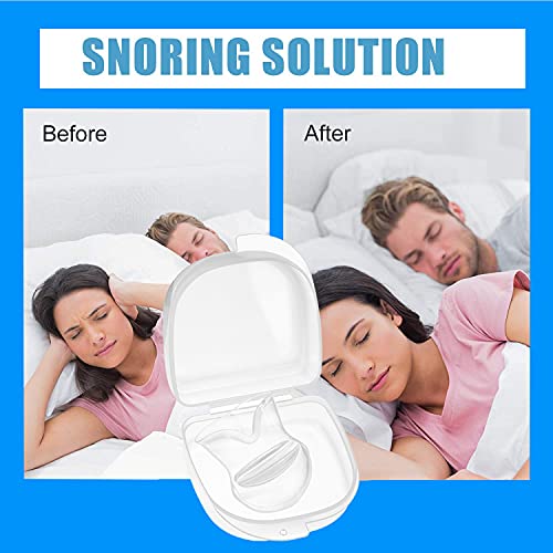 Joruby Snore Stopper Anti Snoring Devices, Snoring Solution Devices, Stop Sno...
