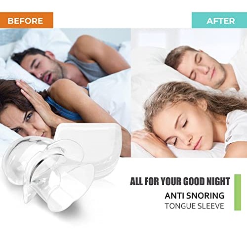 Joruby Snore Stopper Anti Snoring Devices, Snoring Solution Devices, Stop Sno...