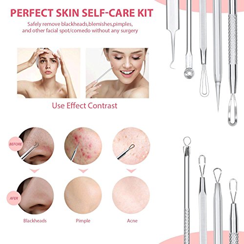 JPNK 6 PCS Blackhead Remover Comedones Extractor Acne Removal Kit for Blemish...