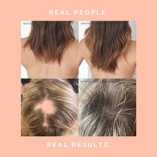 JSHealth Vitamins Hair and Energy Formula | Hair Vitamins for Women and Men |...