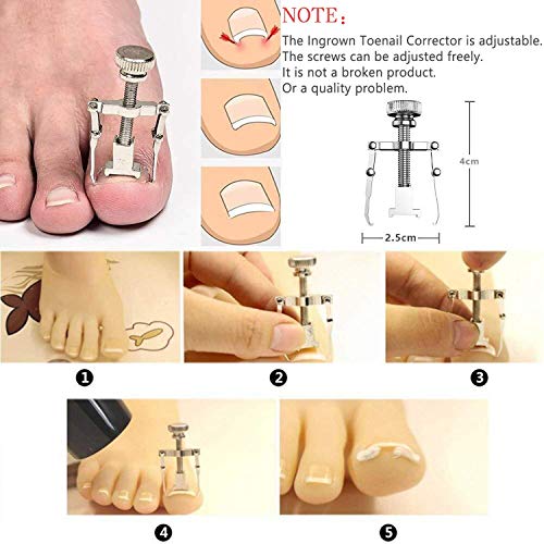 JTIEO Ingrown Toenail Tool Pedicure Tools (9PCS) Ingrown Toenail Treatment To...