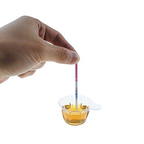 Jyongmer 200 Pack Urine Cups, Disposable Plastic Urine Collection Cups, 40ml ...