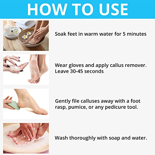 Excuse Me Feet Callus Remover, Liquid Gel for Callus and Corn Remove dead and...