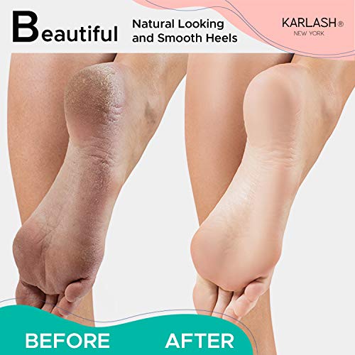 Karlash Professional Pedicure Foot Pumice Stone for Feet Skin Callus Remover ...