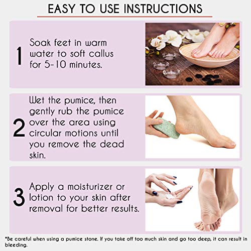 Karlash Professional Pedicure Foot Pumice Stone for Feet Skin Callus Remover ...