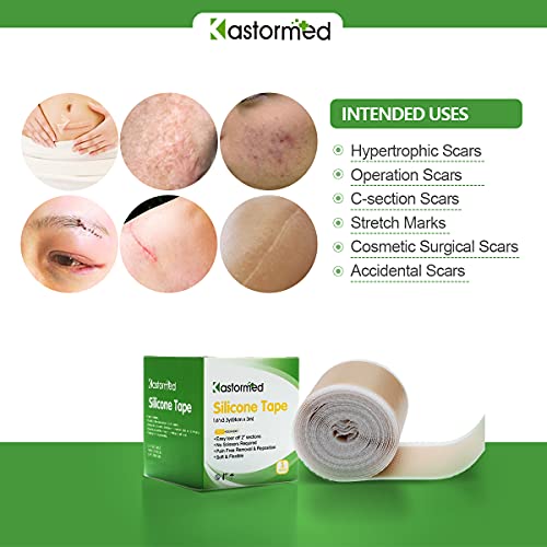 Silicone Tape for Scars, Soft Medical Tape Easy Removal for Keloid Bump Scars...