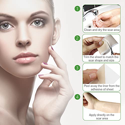 Silicone Tape for Scars, Soft Medical Tape Easy Removal for Keloid Bump Scars...