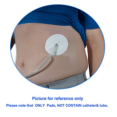 Gtube Pads Holder G Tube Button Pads Peritoneal Dialysis Feeding Tube Peg Tub...