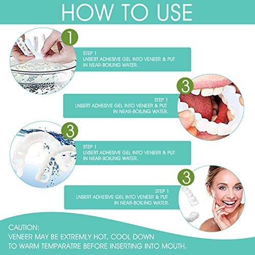 Dentures Teeth Fake Teeth Temporary Teeth and Whitening Alternative Covering ...